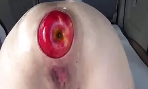 anal fisting ਅਤਿ xxx ...